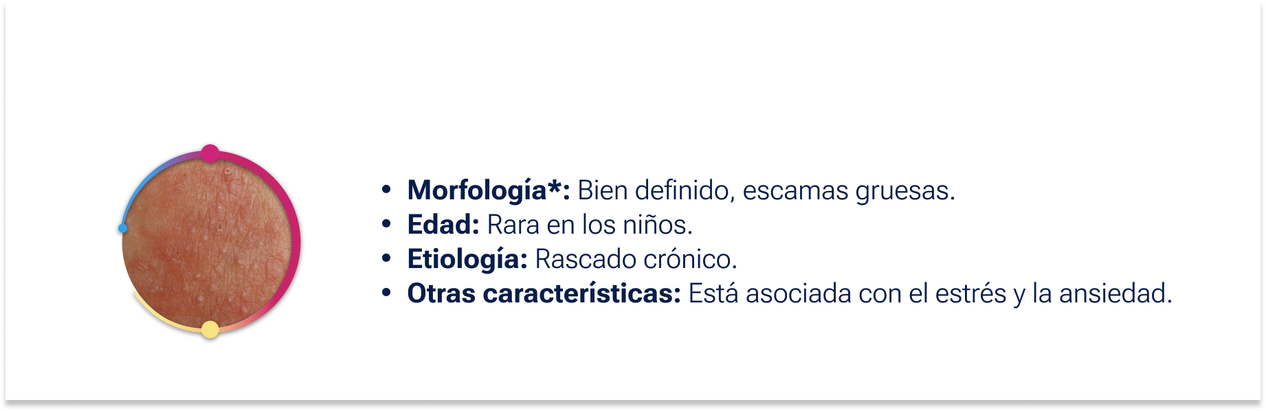 Liquen simple crónico